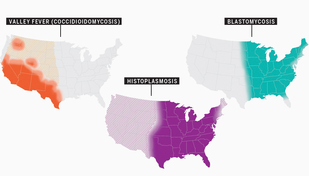 The maps above show the CDC’s current estimates of where the fungi that cause these diseases live in the environment in the US. Darker shading shows areas where the fungi are more likely to live. Diagonal shading shows the potential range of the diseases.