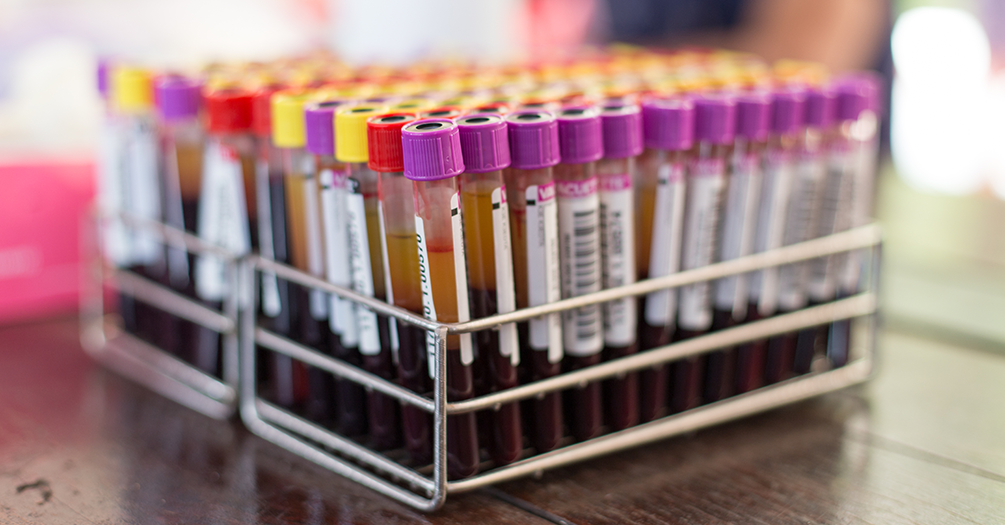 Blood in test tubes