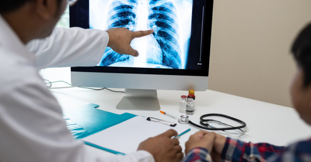 A doctor pointing at a chest X-ray on a computer screen while explaining the results to a patient seated beside them. A stethoscope, clipboard, and medical supplies are on the desk.